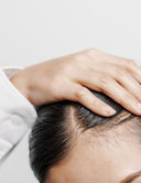 Haarausfall bei Frauen – Ursachen, Verlauf und was wirklich hilft